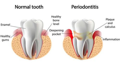 Dental Exam, Teeth Cleaning, X-ray Services In Stoneham, Ma